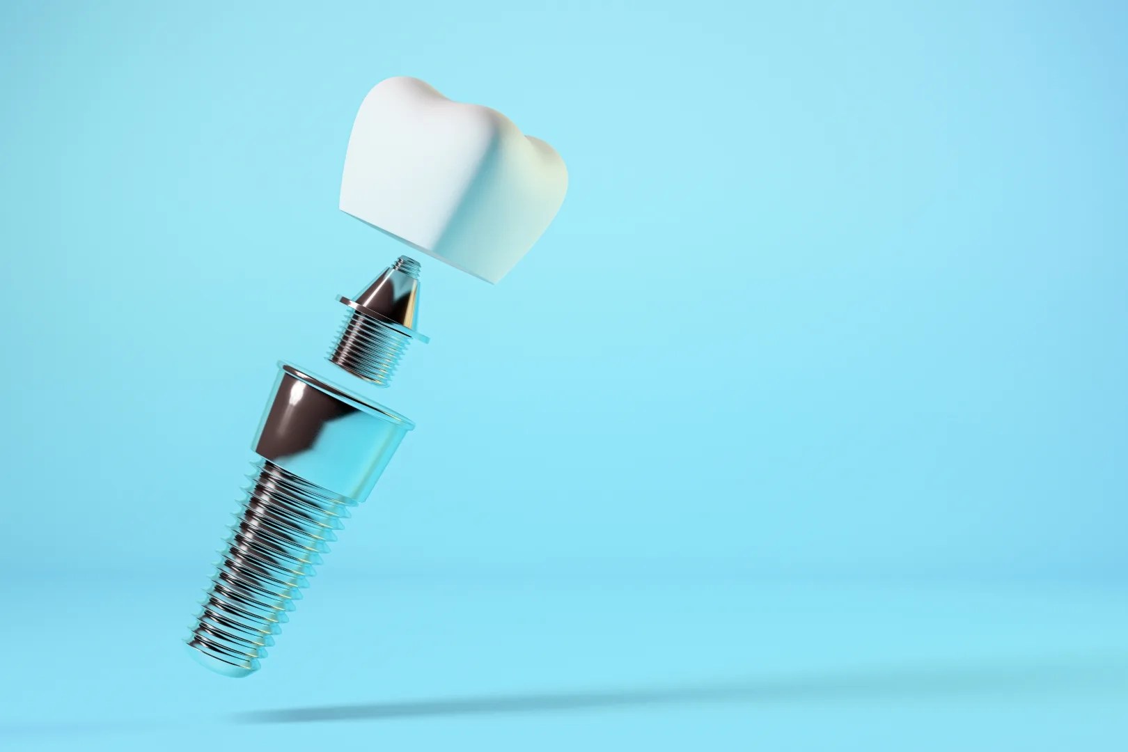 Dental implants 2 jpeg