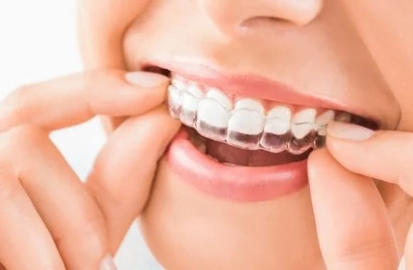 Invisalign box img
