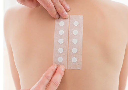 allergy testing