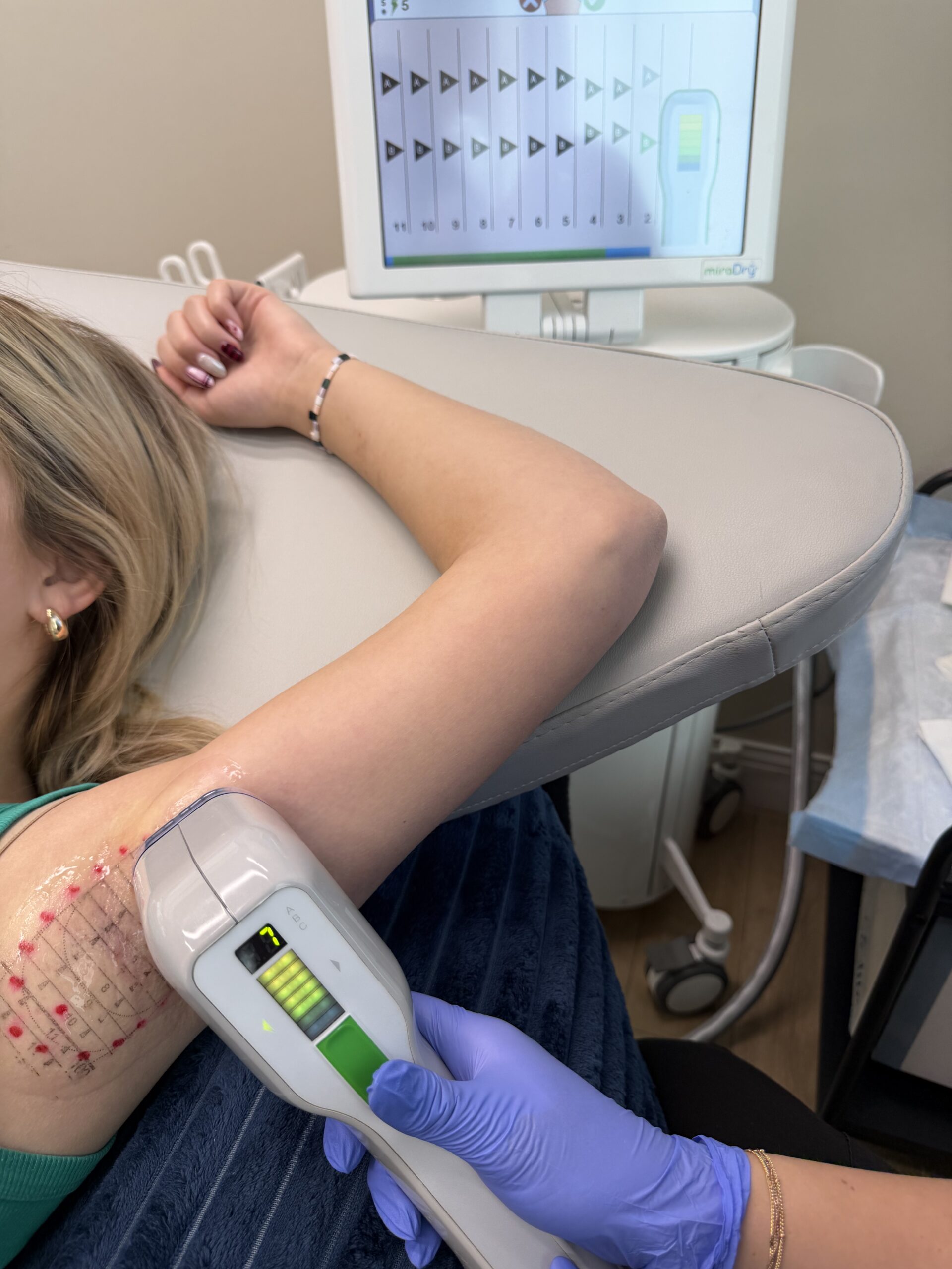 MiraDry Excessive Sweating Reduction Utah Valley Medical Spa