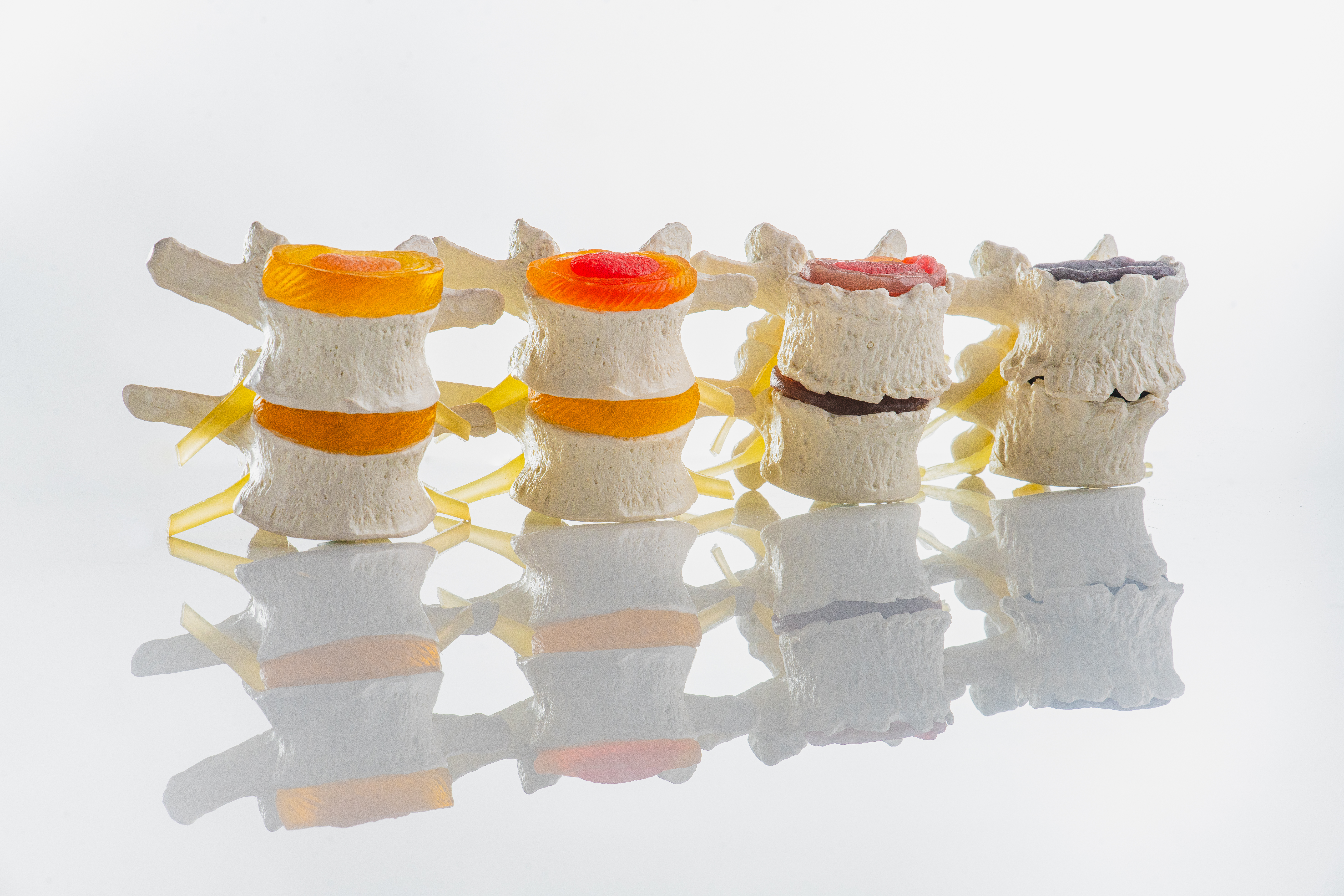 Spinal Decompression Therapy Helpful For Easing Back Issues Cary Nc - Download Gorgeous Light Photo | Mobile