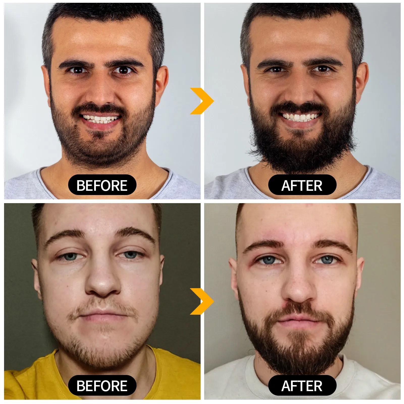 Beard Kit for Men Grooming