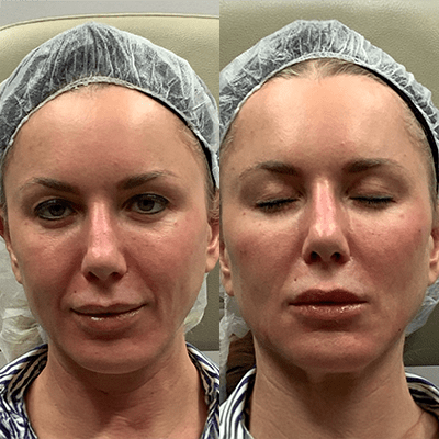 Two photos of a woman with her eyes open and closed.