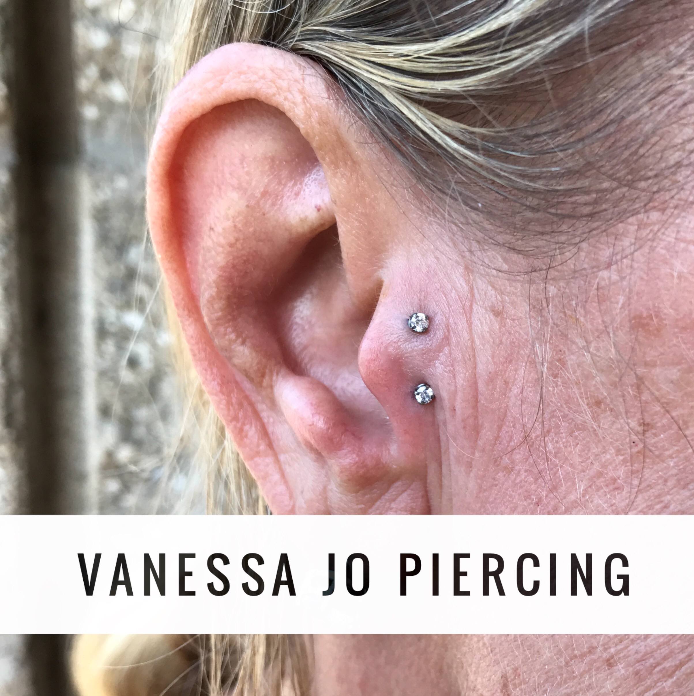 Double tragus with Neometal titanium