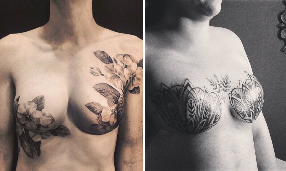 Cicatriz mama fotos tatuagem 1