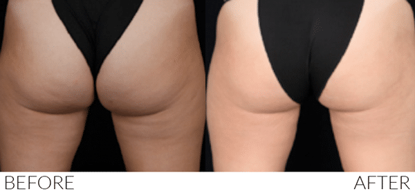 "Before and after image showing visible results"