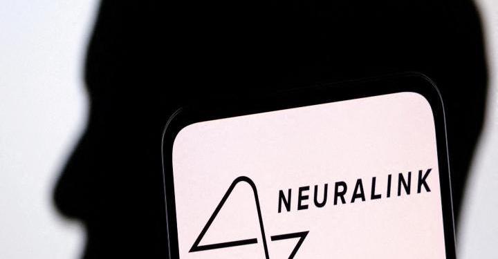 ¿La nueva evolución? Neuralink, con aprobación para estudios de implantes cerebrales en humanos 1 ¿La nueva evolución? Neuralink, con aprobación para estudios de implantes cerebrales en humanos