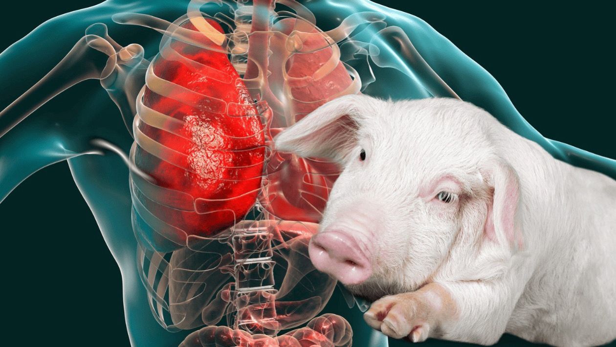 China realiza el primer trasplante de pulmón de cerdo a humano