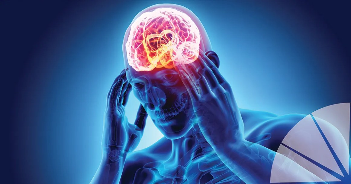 Este es el cáncer cerebral que erosiona los huesos del cráneo 2 Este es el cáncer cerebral que erosiona los huesos del cráneo