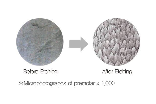 etchant-1.webp