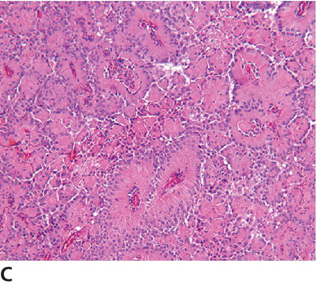 健康・医学 Surgical Pathology of Canine Neoplasms The Veterinary Nurse - Knowing your way around 'the big C' in