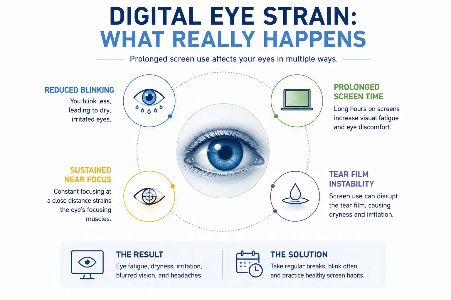 Infographic showing major contributors to digital eye strain including reduced blinking and prolonged near focus