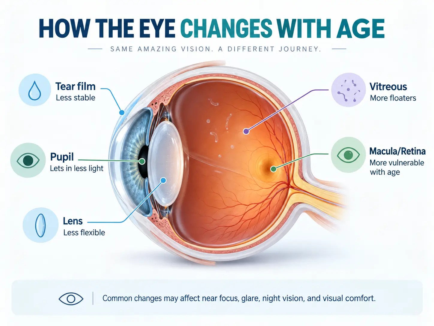 Infographic showing a cross-section of the human eye with age-related changes in the tear film, pupil, lens, vitreous, retina, and macula