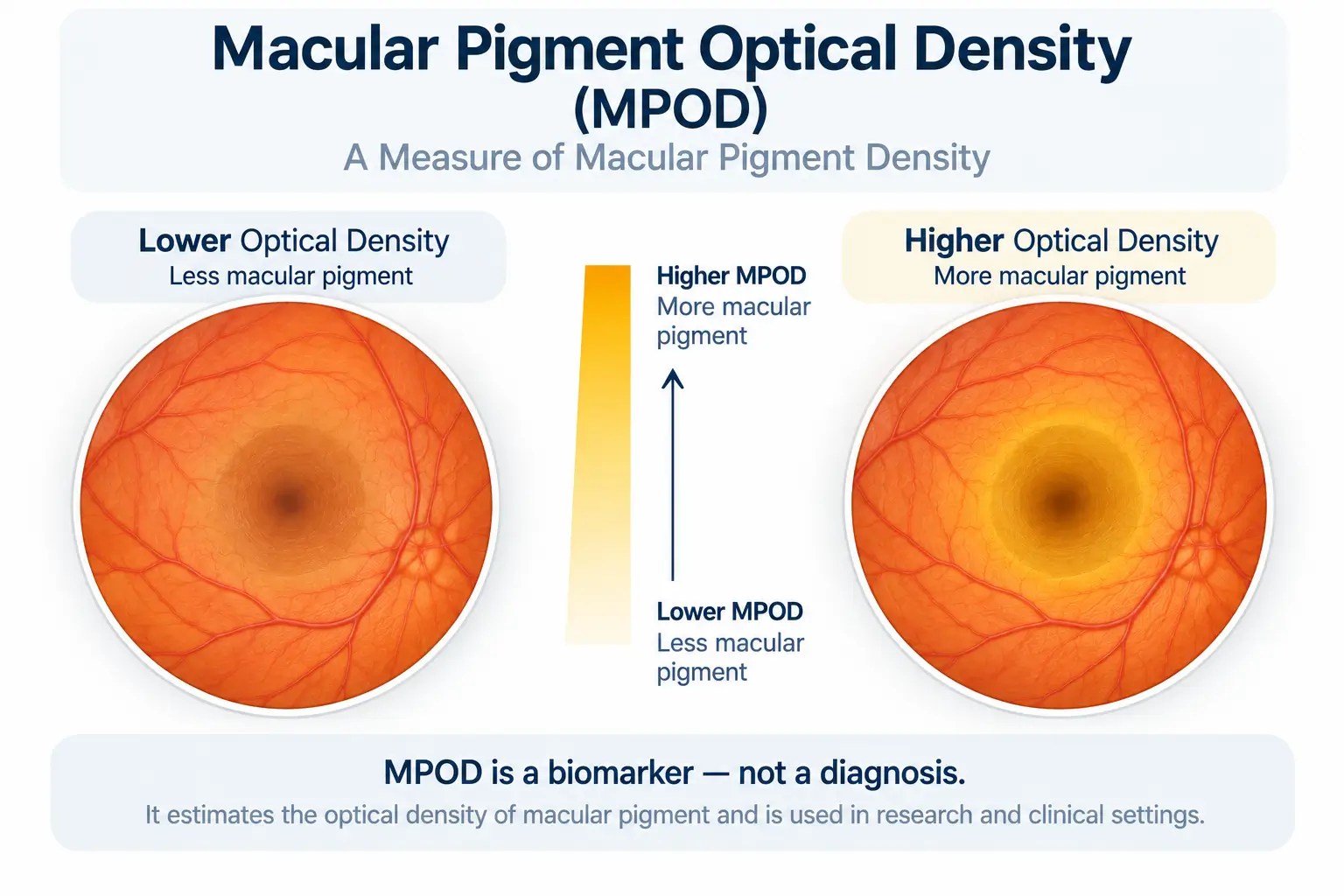 Illustration explaining macular pigment optical density, or MPOD, as a measure of macular pigment density