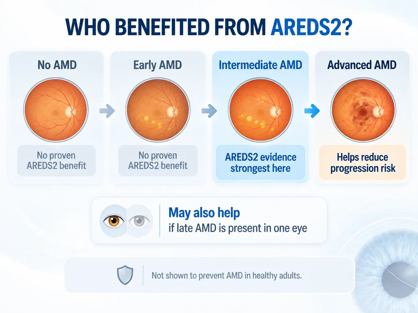 AMD progression from no AMD to early, intermediate, and advanced AMD, highlighting where AREDS2 evidence is strongest