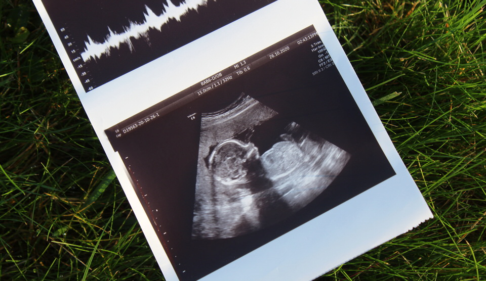 Primitive Reflexes and the Whole Person: Part One – What Are We Really Seeing?