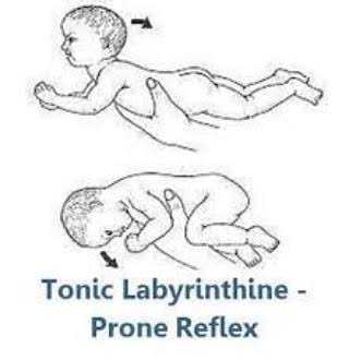 Primitive Reflexes and the Whole Person: Part Three – Retained TLR
