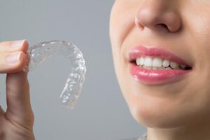 Clear Aligners
