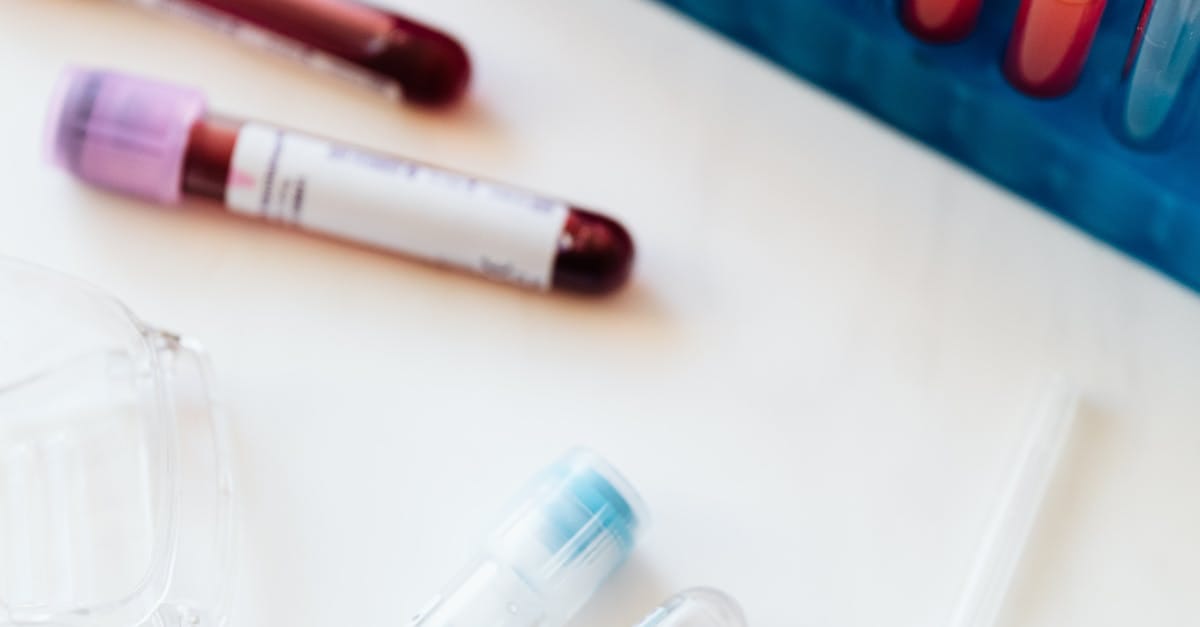 Medical professional in a lab coat examining prostate cancer blood test results on a computer screen.