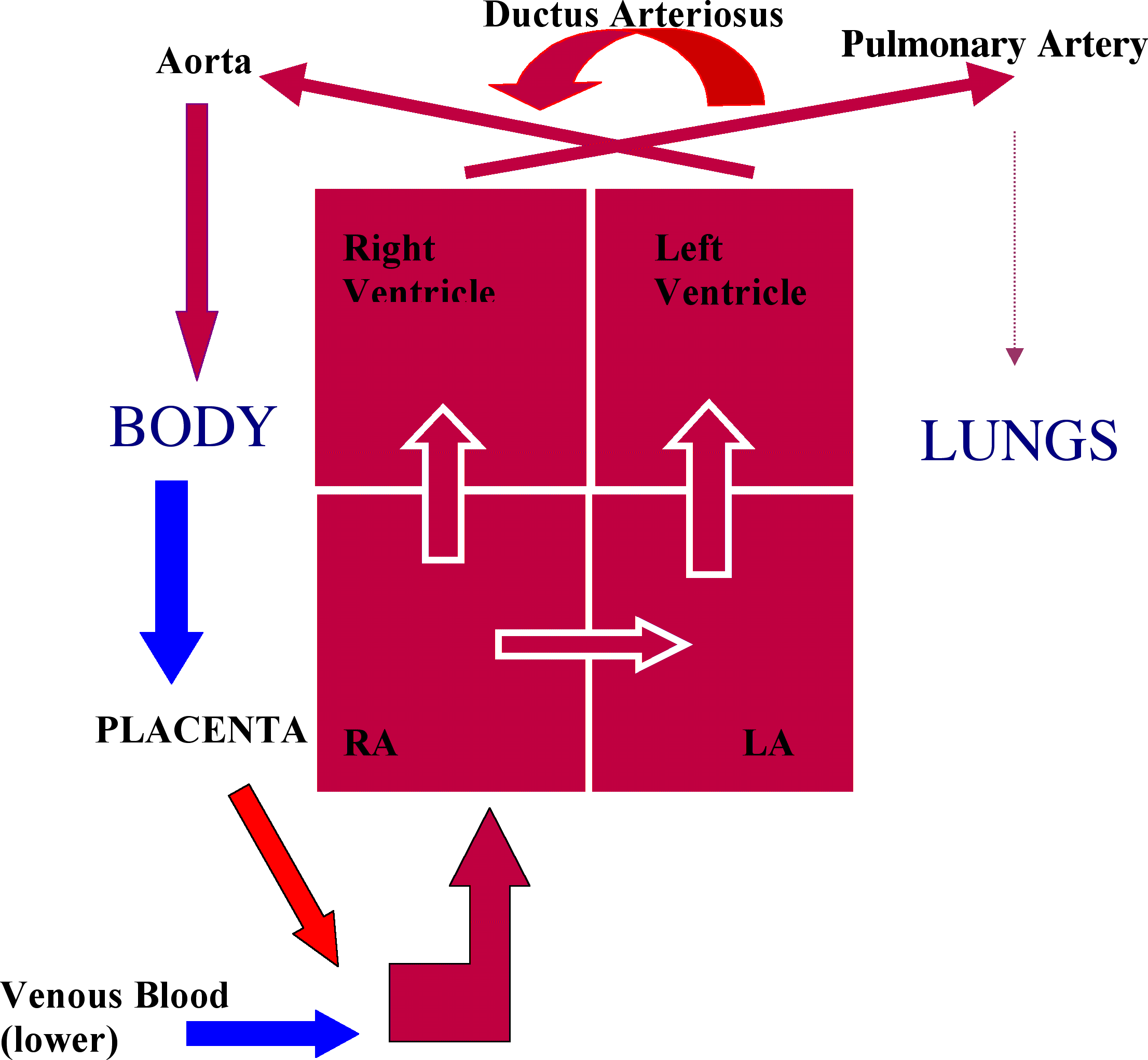 Ductus arteriosus protects lungs against circulatory overload allows the right ventricle to strengthen · 2. Untitled Document