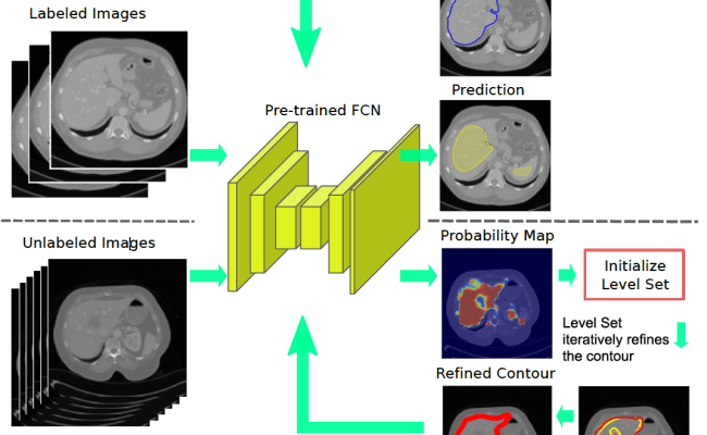 Medical Image Segmentation Using Deep Learning A Survey At George Arias ...