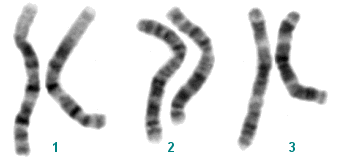 Metacentric chromosome definition at dictionary.com, a free online dictionary with pronunciation, synonyms and translation. Metacentric Chromosomes Centromere Chromosome Structures Genetic Structures Wellness Advocate Com