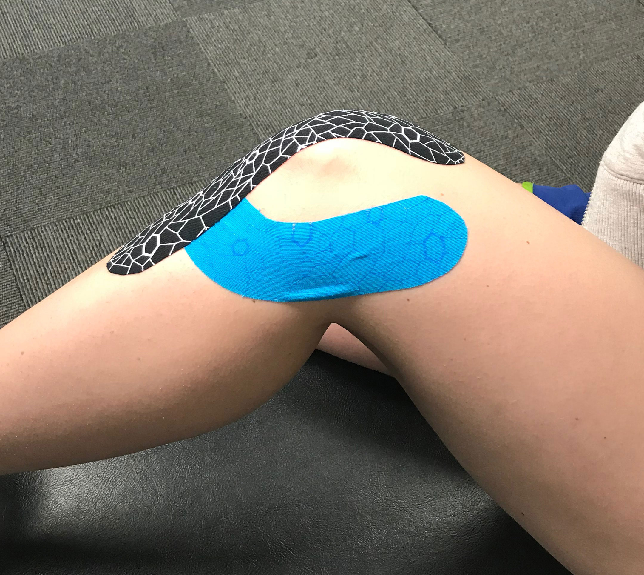 Close-up of a knee wrapped with athletic tape for support.