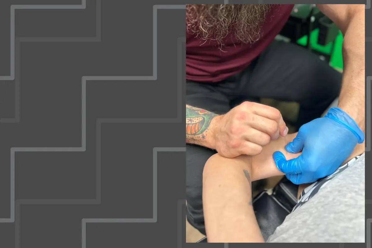Dry needling treatment being performed at Wellness Solutions Chiropractic in St. Louis County to relieve muscle tension and improve mobility