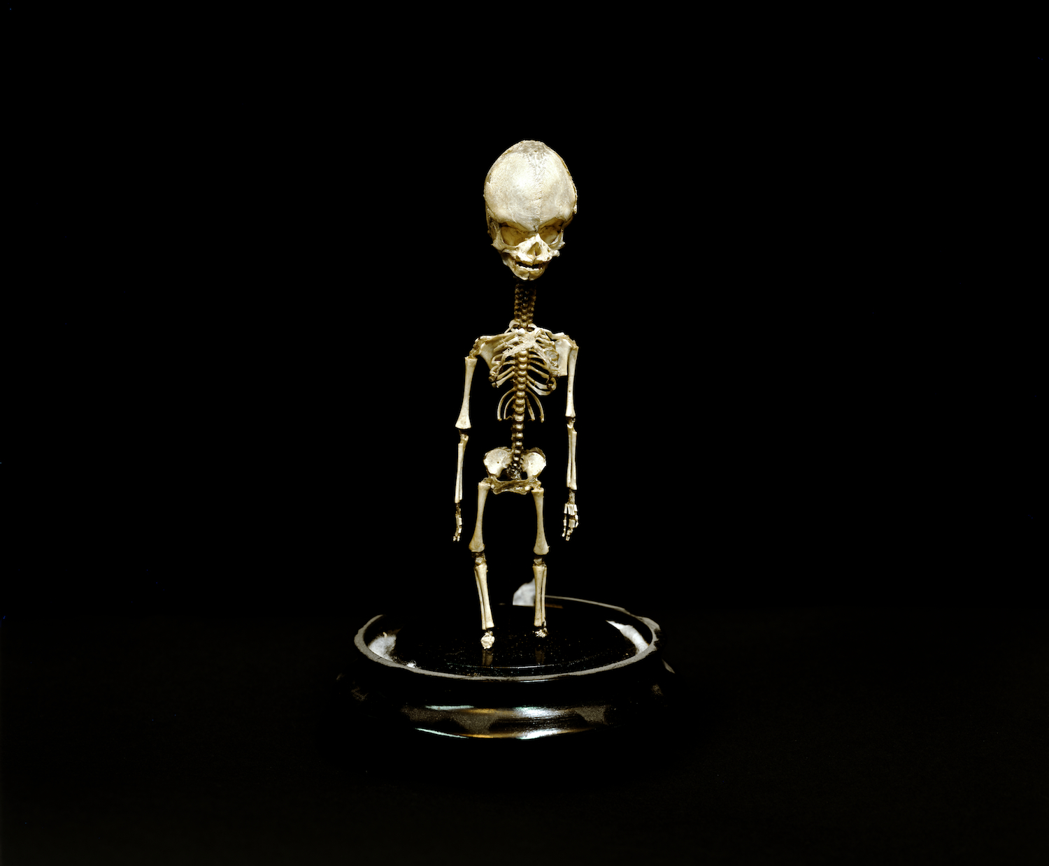 “Little Skeleton, Mutter Museum, 2004” by Neal Rantoul (courtesy of the artist and 555 Gallery, Boston)