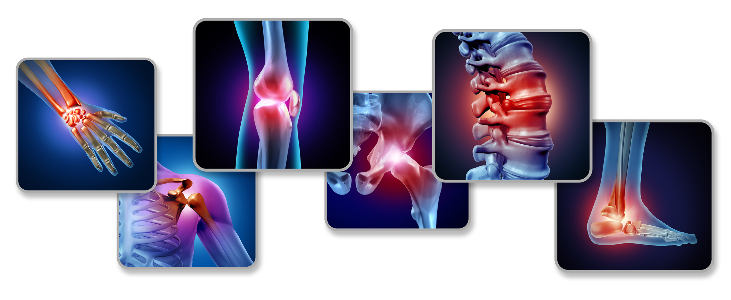 examples of joint pain