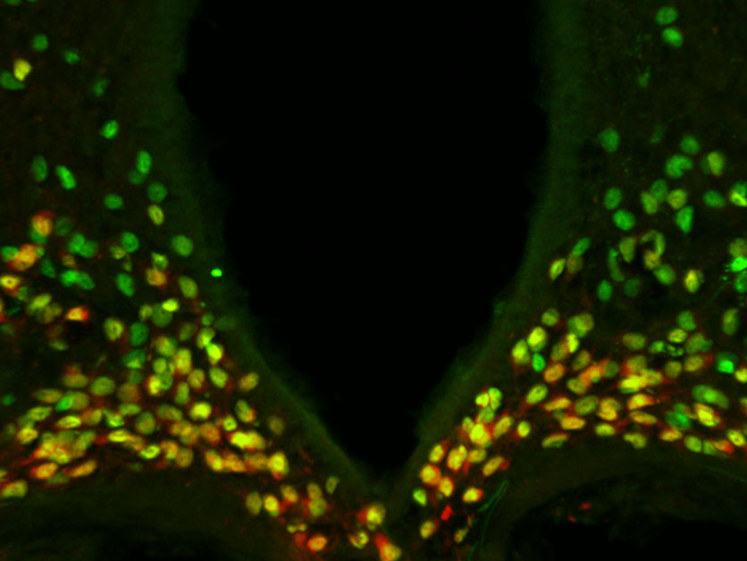 The Brain's Master Switch: Gene Controls Stress, Metabolism, and Behavior (2026)