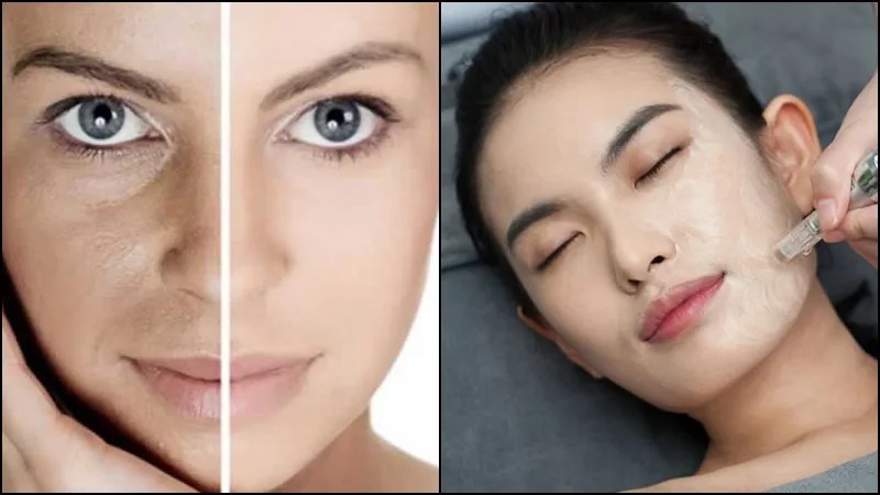 BB Glow – Tratamento facial Coreano BB Glow - Tratamento facial Coreano