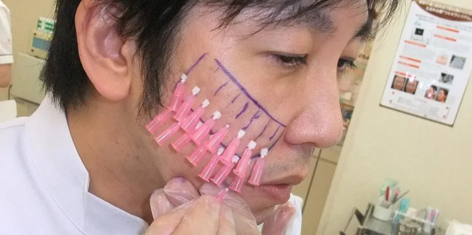 12 Procedimentos estéticos que só existem no Japão