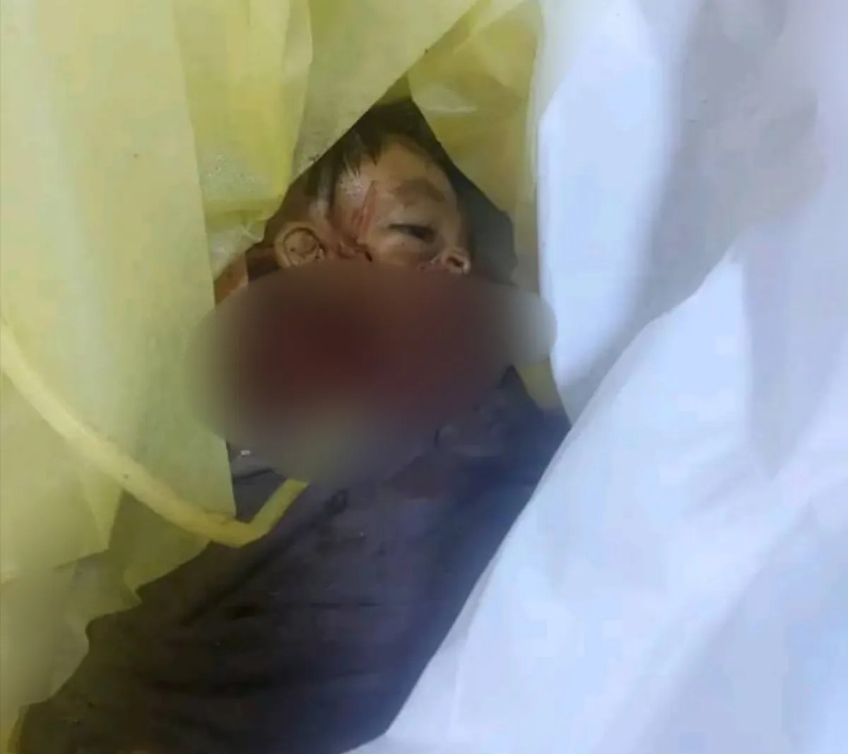 التكتل الوطني للأحزاب: استهداف المدنيين في حيران جريمة حرب مكتملة وندعو إلى إحالتها للقضاء الدولي التكتل الوطني للأحزاب: استهداف المدنيين في حيران جريمة حرب مكتملة وندعو إلى إحالتها للقضاء الدولي