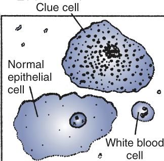 Clue Cells