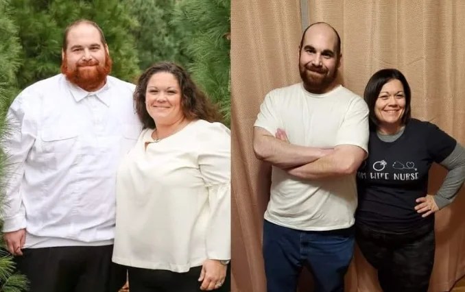why is it important to understand that body contouring and skin care are vitally linked when losing weight? - Motivated adults reviewing fitness and body contouring results, discussing sustainable body contouring and skin care strategies in a clinical or home setting.