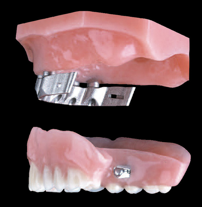 Dental arts lab focuses on restorative excellence