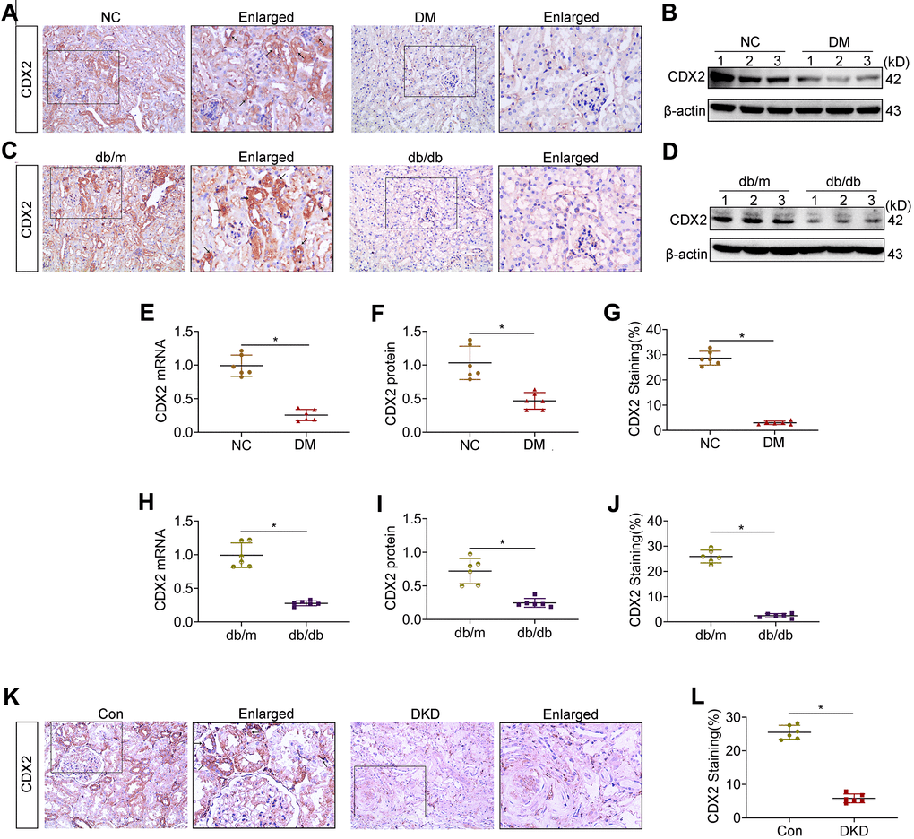The role of CDX2 in renal tubular lesions during diabetic kidney disease | Aging