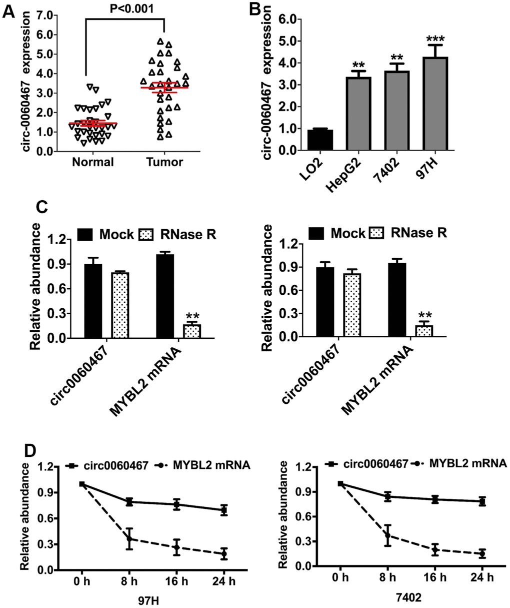 Circ0060467 sponges miR-6805 to promote hepatocellular carcinoma  progression through regulating AIFM2 and GPX4 expression | Aging