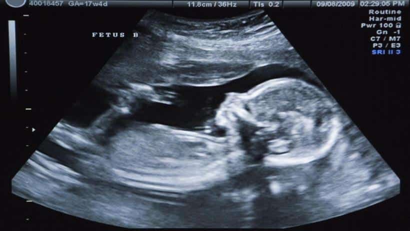 Le père aide sa femme enceinte. Femme Enceinte Et Islam Voici L Alimentation Adaptee En Periode De Grossesse