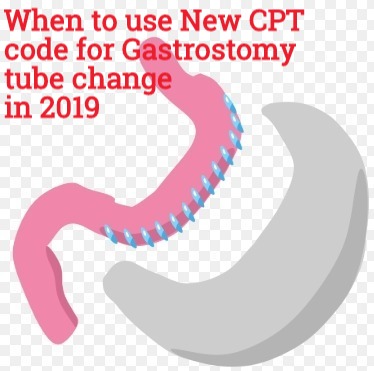 When To Use Cpt Code 43762 43763 For Gastrostomy Tube Change