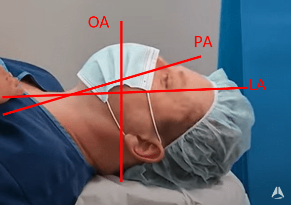 Optimal patient positioning for intubation and airway management