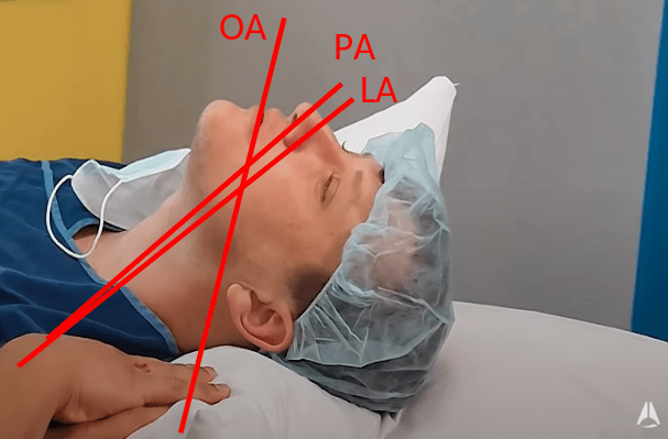 Optimal patient positioning for intubation and airway management