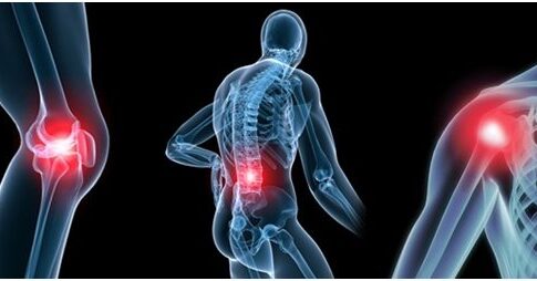 joint-pain-highlight-485x254