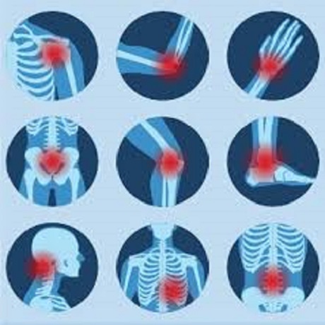 painspots-xray-460x460