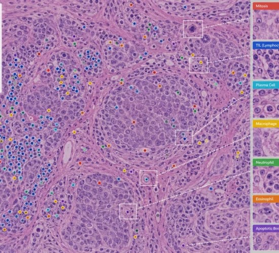 7. Annotation tab 2 — Cell Detection