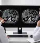Medical specialists reviewing inconsistent tumour segmentation boundaries on a CT scan.