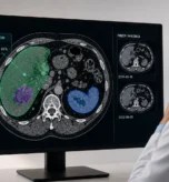 Radiologist reviewing an AI-annotated CT scan with lesion detection and prior imaging comparison.