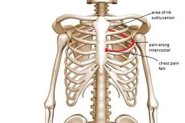 The heart is located under the rib cage, to the left of the breastbone (sternum) and between the lungs. When Chest Pain Is Not A Heart Attack