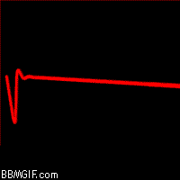 Resultado de imagen para actividad cardiaca gif